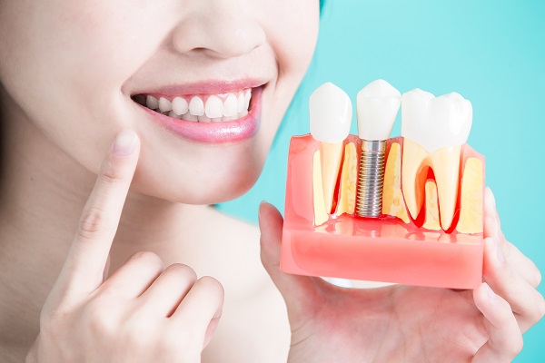 The Of Supported Dentures
