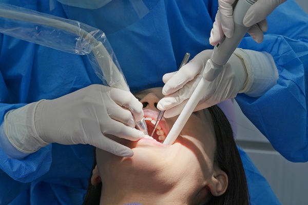 Deep Teeth Cleaning: What To Expect And Why It Matters