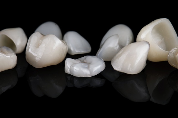 How To Take Care Of A Dental Crown