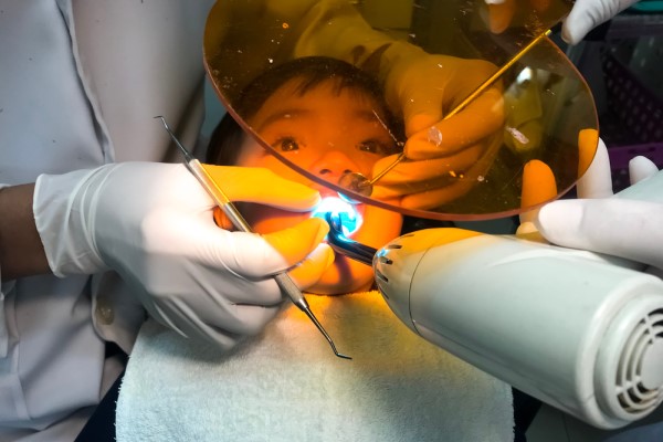 Dental Sealants New Albany, IN