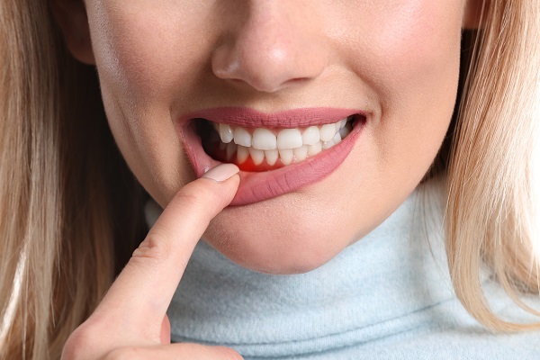 What Happens If Gum Disease Is Left Untreated?