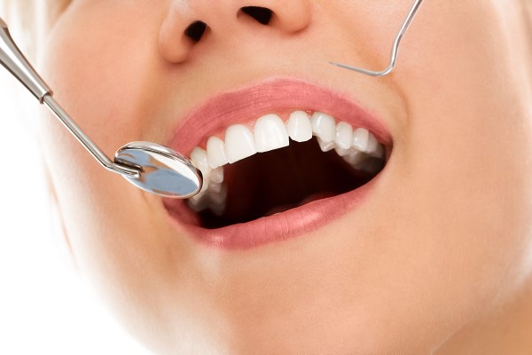 Dental Deep Cleaning For Gum Infection