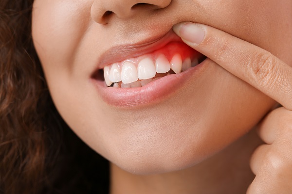 Gum Disease Treatment New Albany, IN
