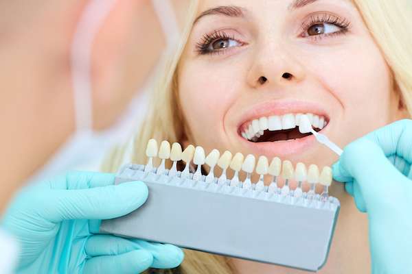 How a Cosmetic Dentist Places Dental Veneers from River Falls Family Dental in New Albany, IN