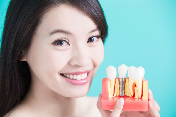 A Step By Step Guide To Getting An Implant Crown