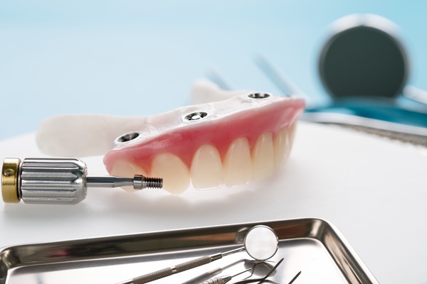 A Guide To The Implant Supported Dentures Procedure