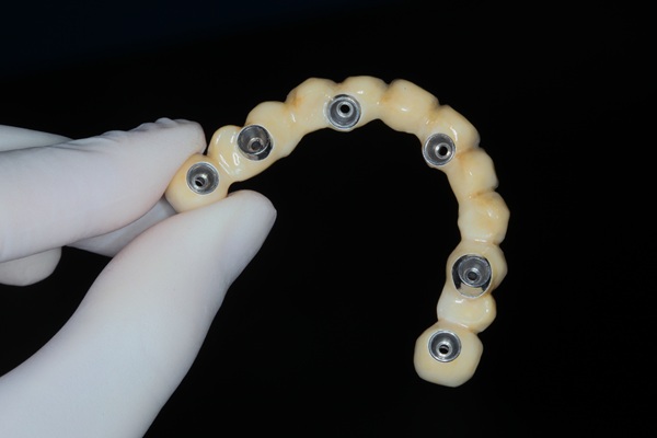 Implant Supported Dentures Guide: Process, Benefits, And Care