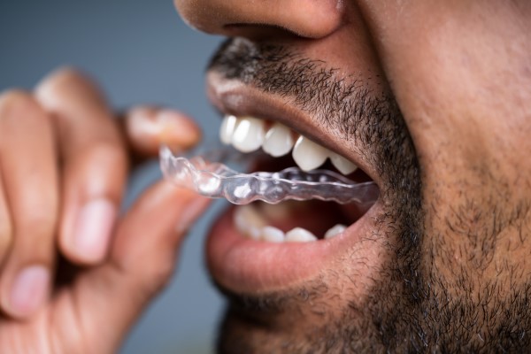 How Durable Is A Mouthguard?
