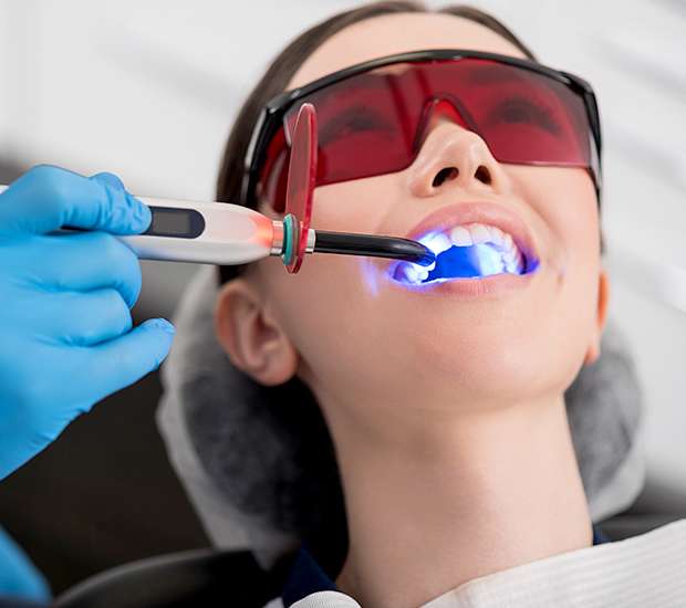 New Albany Professional Teeth Whitening